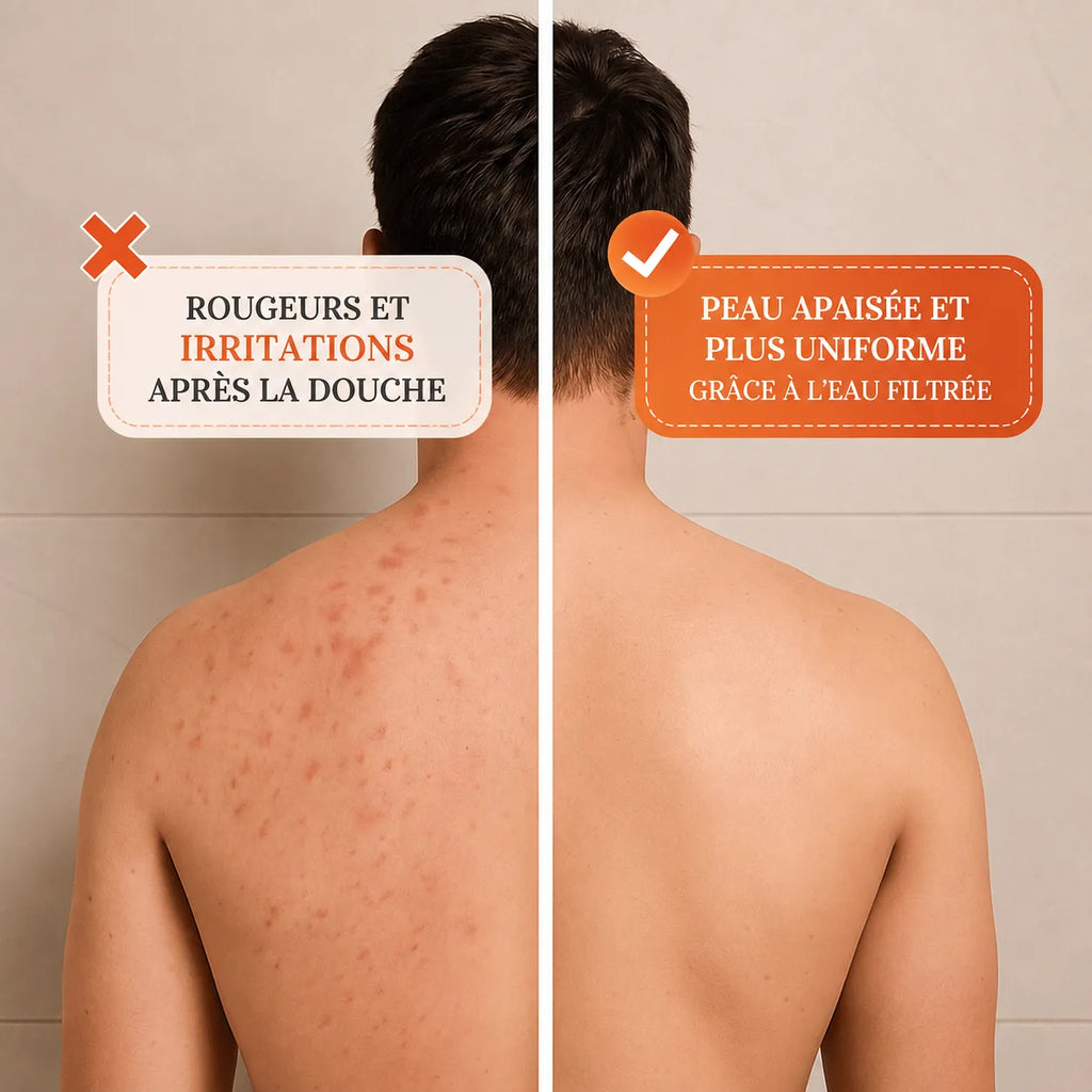 Doucéa™ – Pommeau de douche filtrant